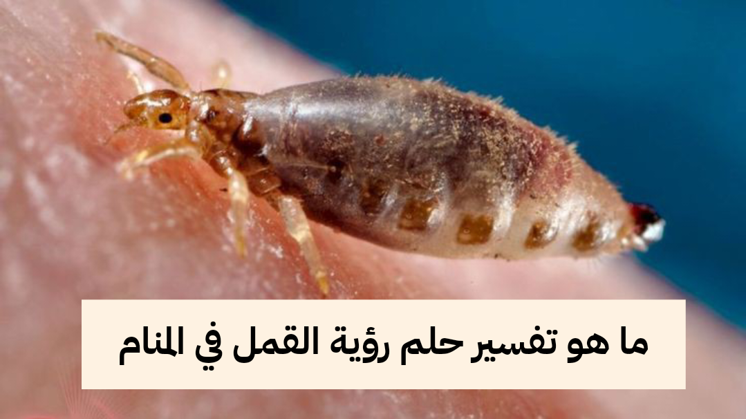 ما هو تفسير حلم رؤية القمل في المنام