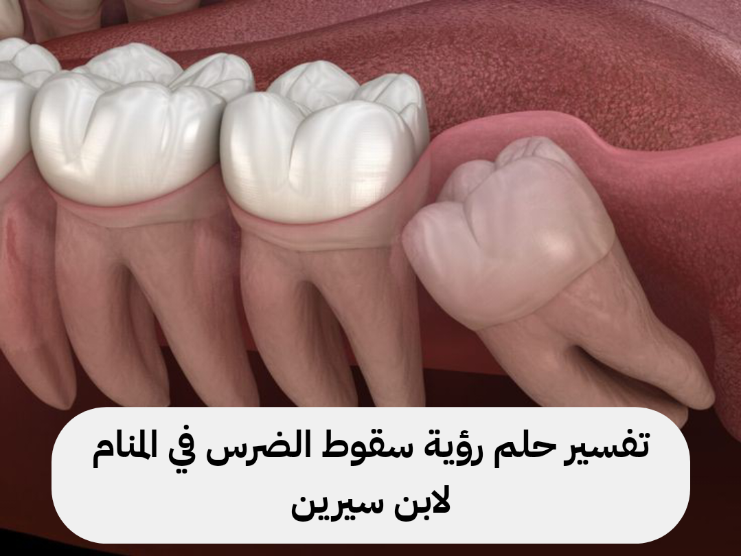 تفسير حلم رؤية سقوط الضرس في المنام لابن سيرين