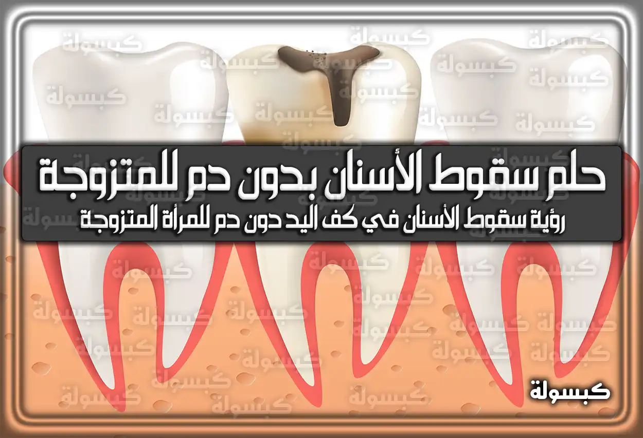 تفسير حلم رؤية سقوط الأسنان بدون دم للمتزوجة في المنام