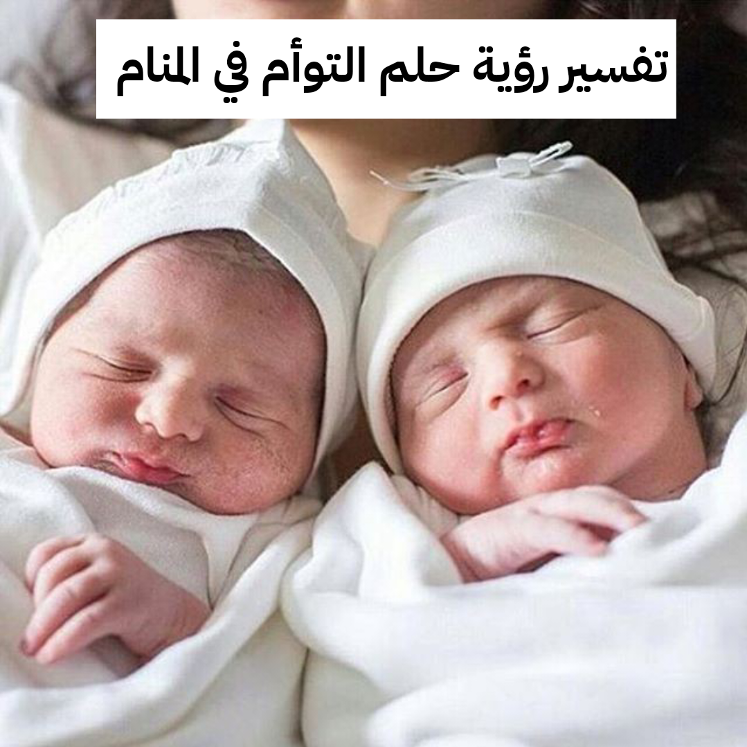 تفسير رؤية حلم التوأم في المنام .. أبرز 4 رموز للنابلسي