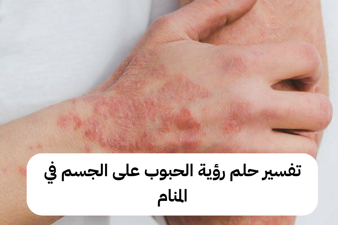 تفسير حلم رؤية الحبوب على الجسم في المنام