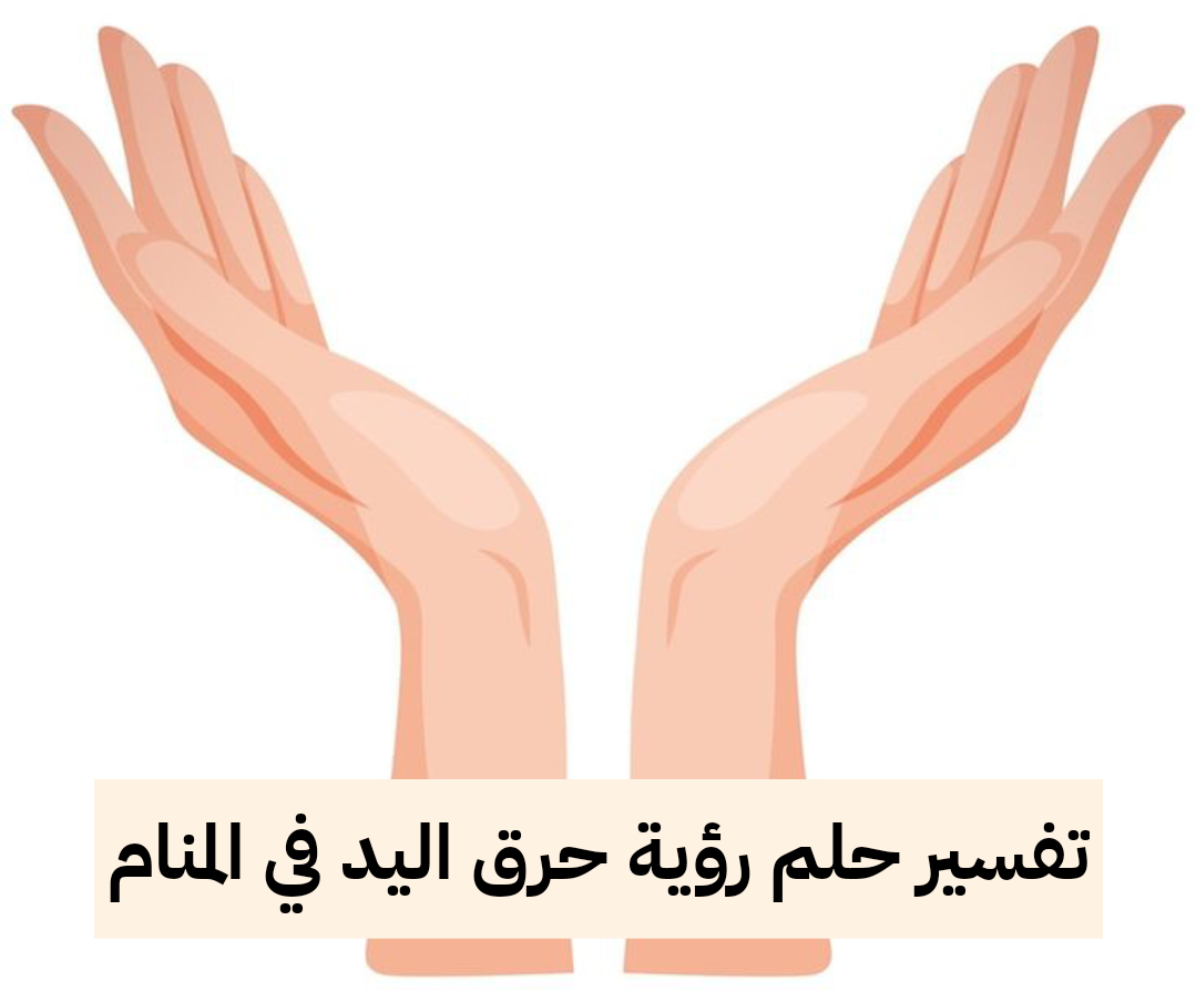 تفسير حلم رؤية حرق اليد في المنام