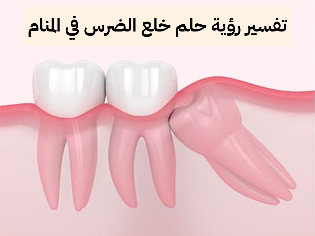 تفسير رؤية حلم خلع الضرس في المنام بالتفصيل .. 7 تفسيرات مختلفة لخلع الضرس في الحلم