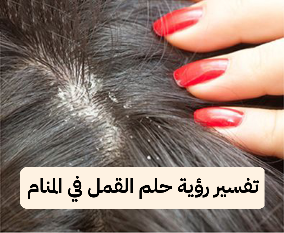 تفسير رؤية حلم القمل في المنام للمراه للعزباء وللمتزوجة وللرجل