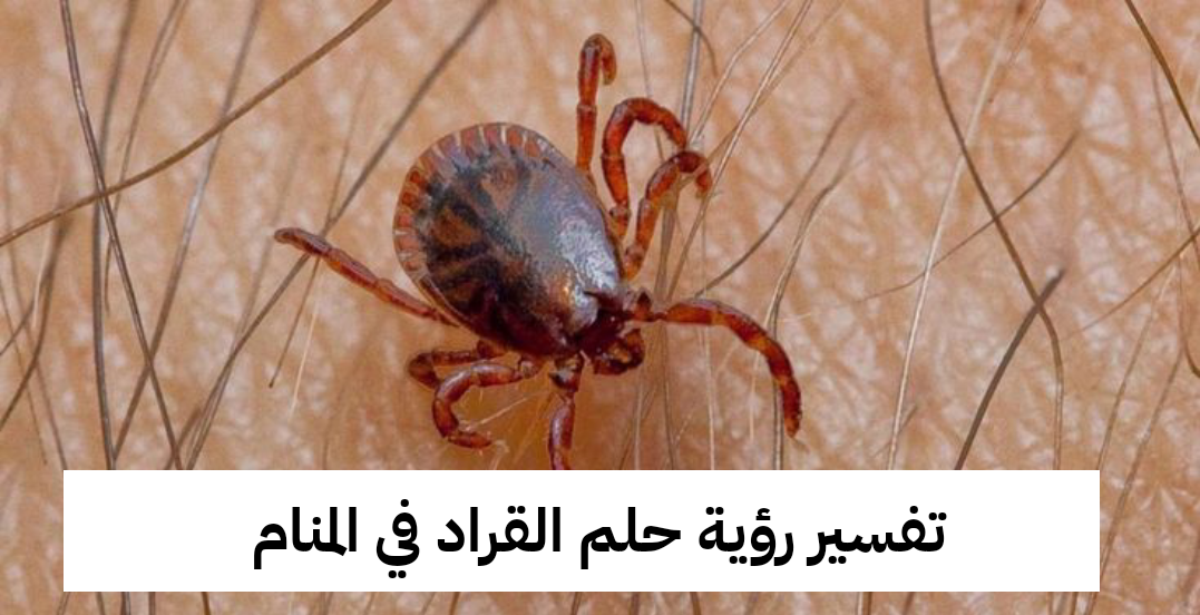 تفسير رؤية حلم القراد في المنام