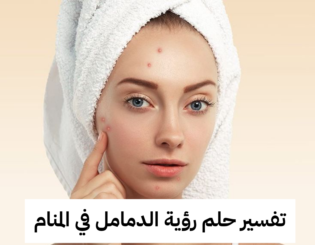 تفسير حلم رؤية الدمامل في المنام