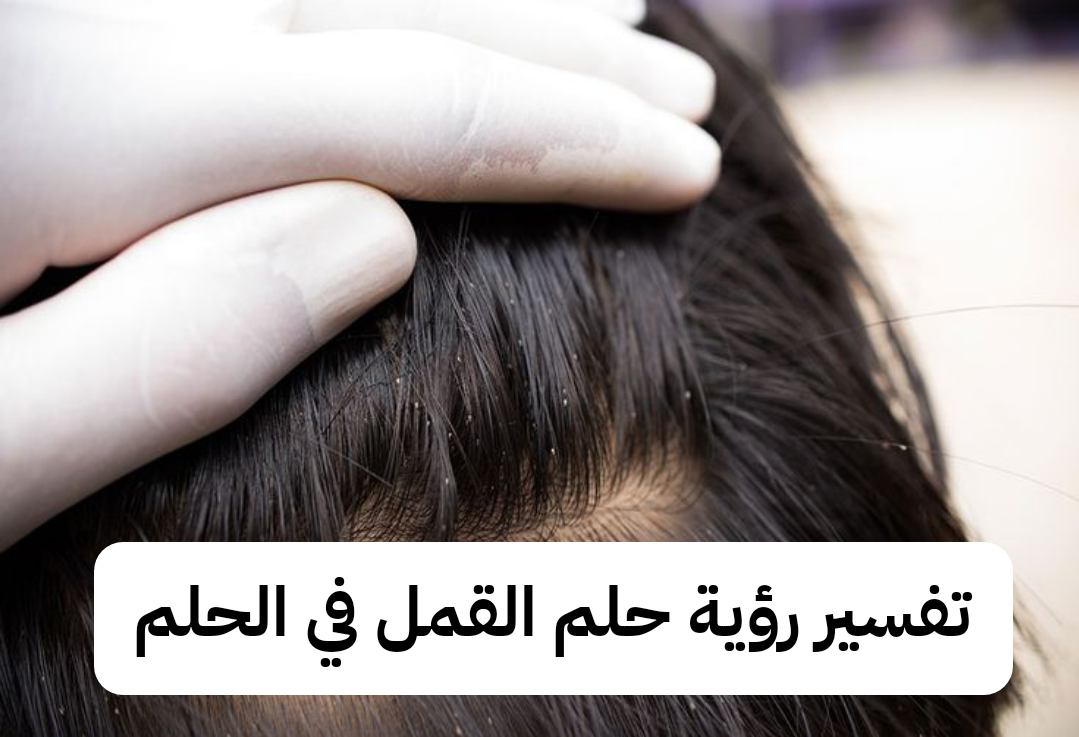 تفسير رؤية حلم القمل في الحلم للرجل وللمرأة