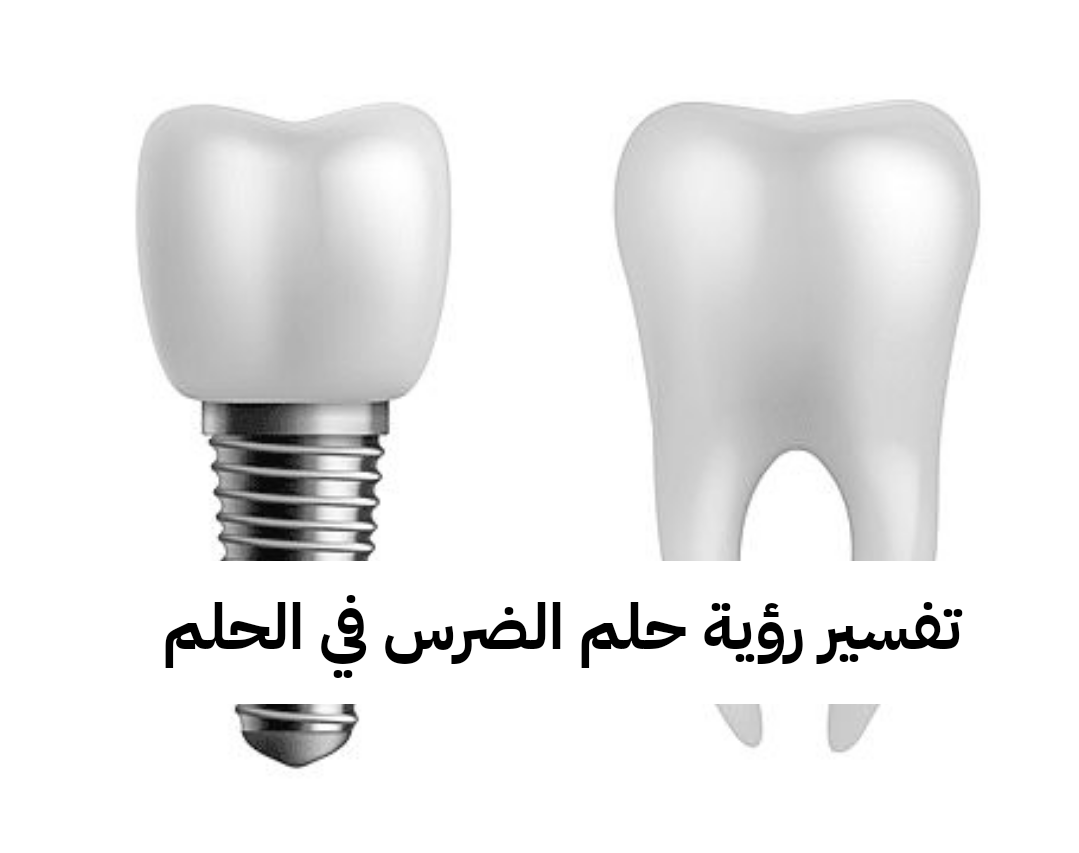 تفسير رؤية حلم الضرس في الحلم لابن سيرين .. أموال كثيرة للعزباء