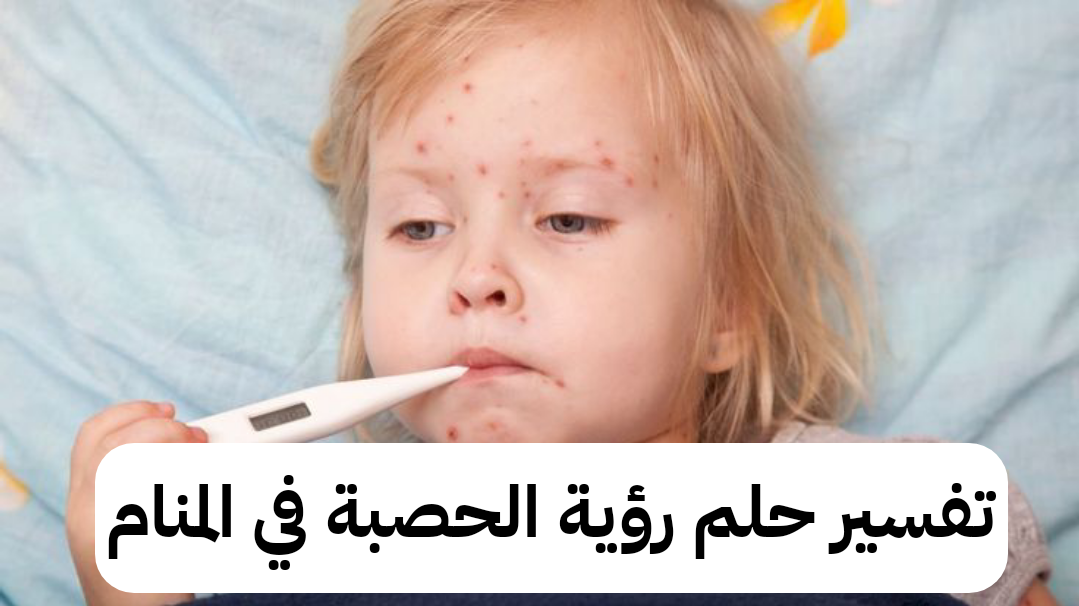 تفسير حلم رؤية الحصبة في المنام