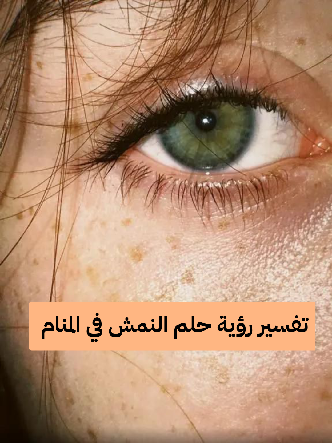 تفسير رؤية حلم النمش في المنام .. تعرف متي يرمز للمال في الحلم