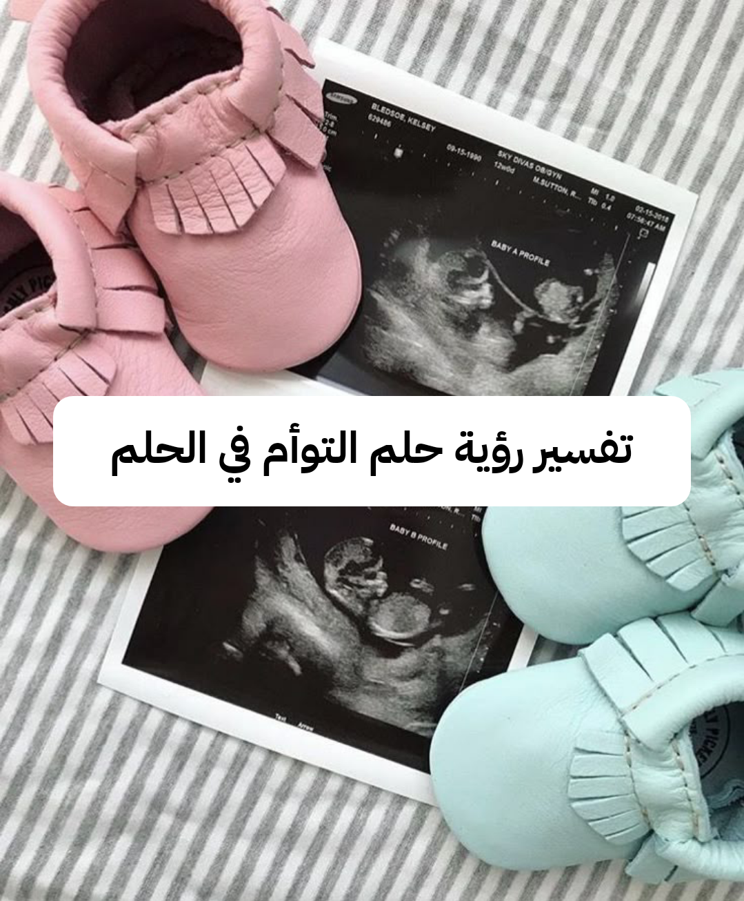 تفسير رؤية حلم التوأم في الحلم .. ثروة مالية قادمة وحظ سعيد