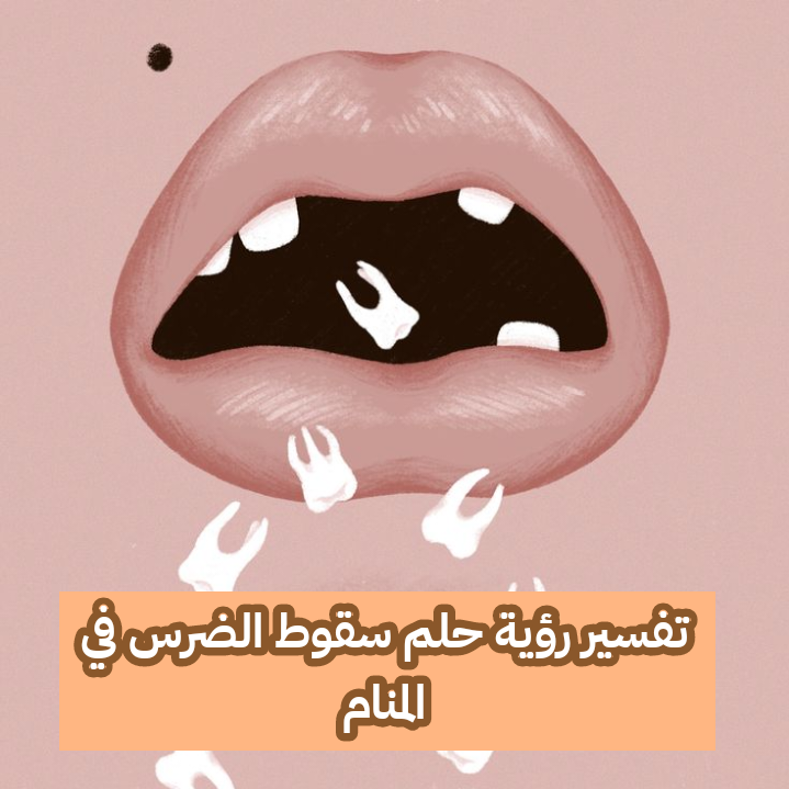تفسير رؤية حلم سقوط الضرس في المنام