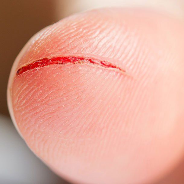 تفسير رؤية الجرح في الحلم