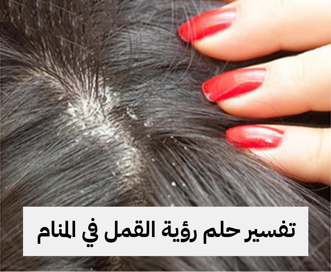 تفسير حلم رؤية القمل في المنام للعزباء والمتزوجة والرجل