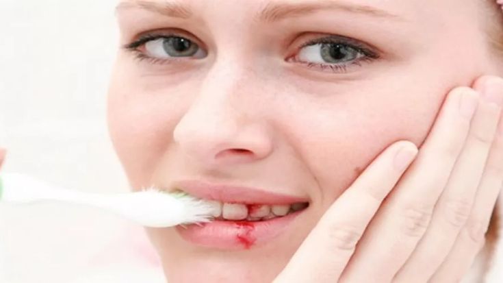 تفسير حلم النزيف