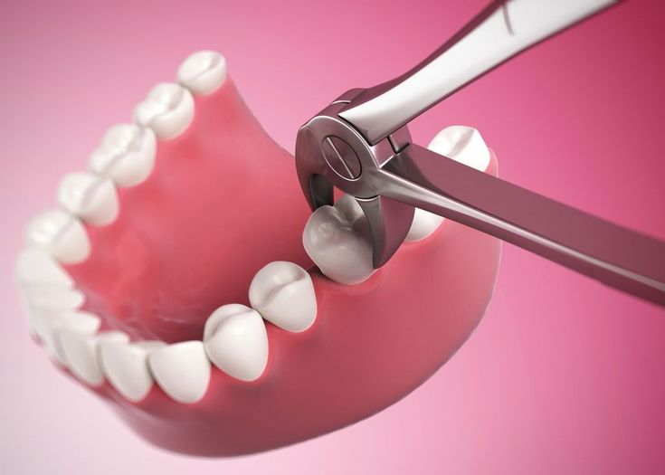 تفسير حلم سقوط الضرس