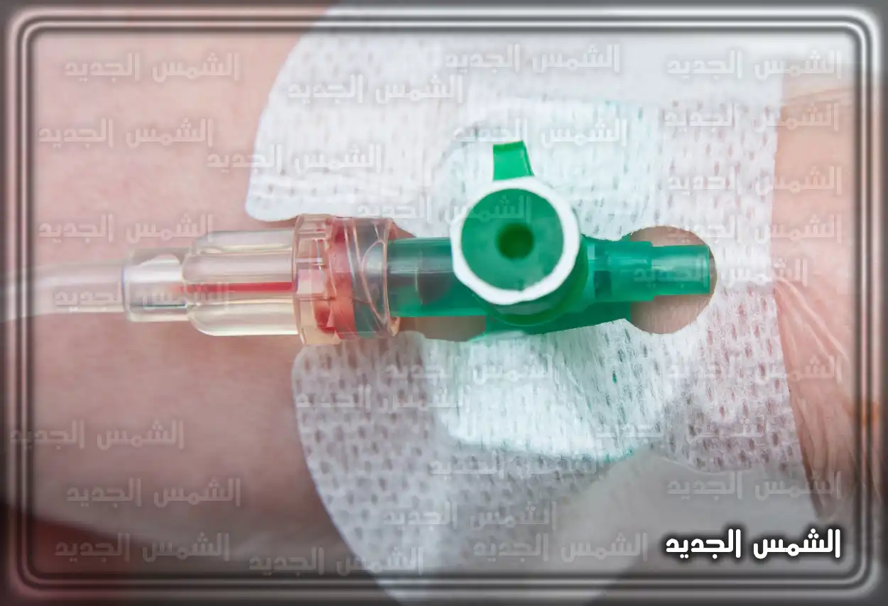 طريقة تركيب الكانيولا للمبتدئين