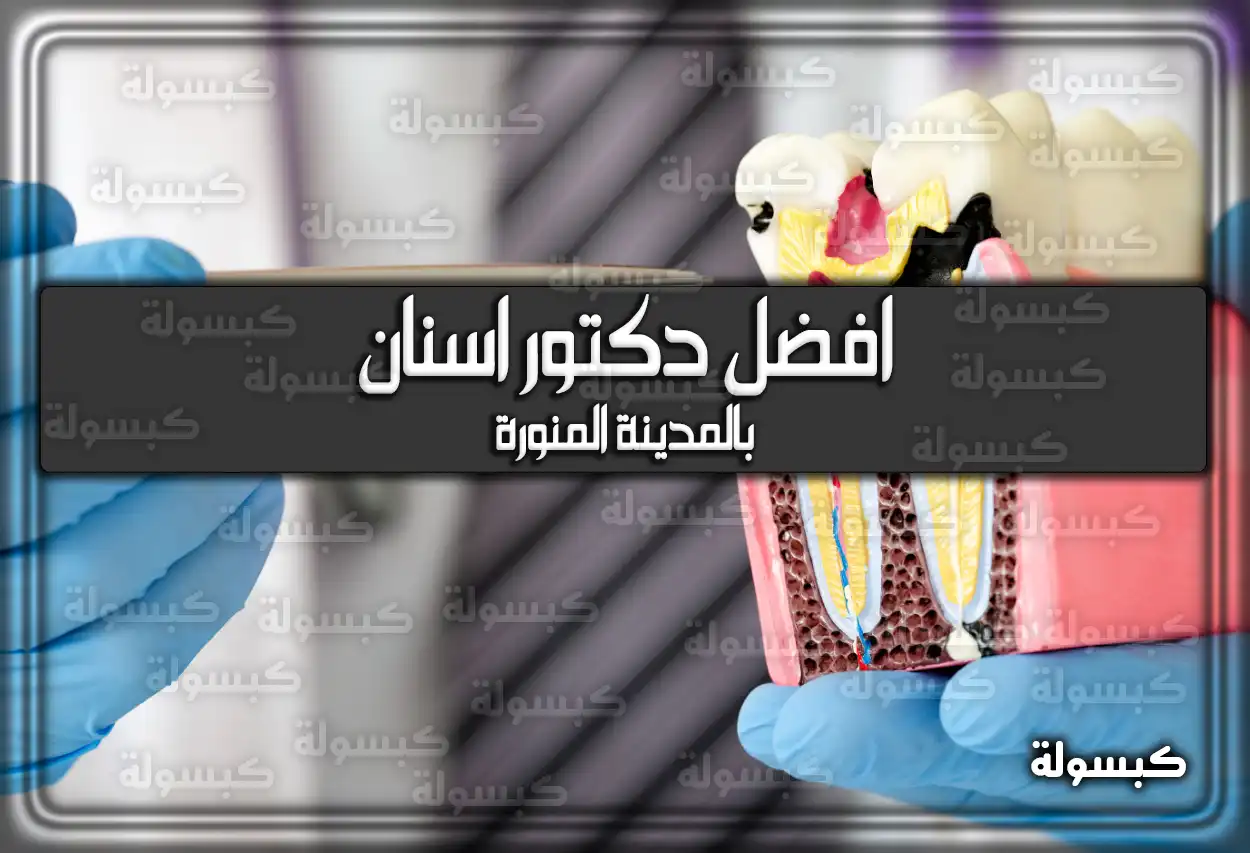 افضل دكتور اسنان بالمدينة المنورة