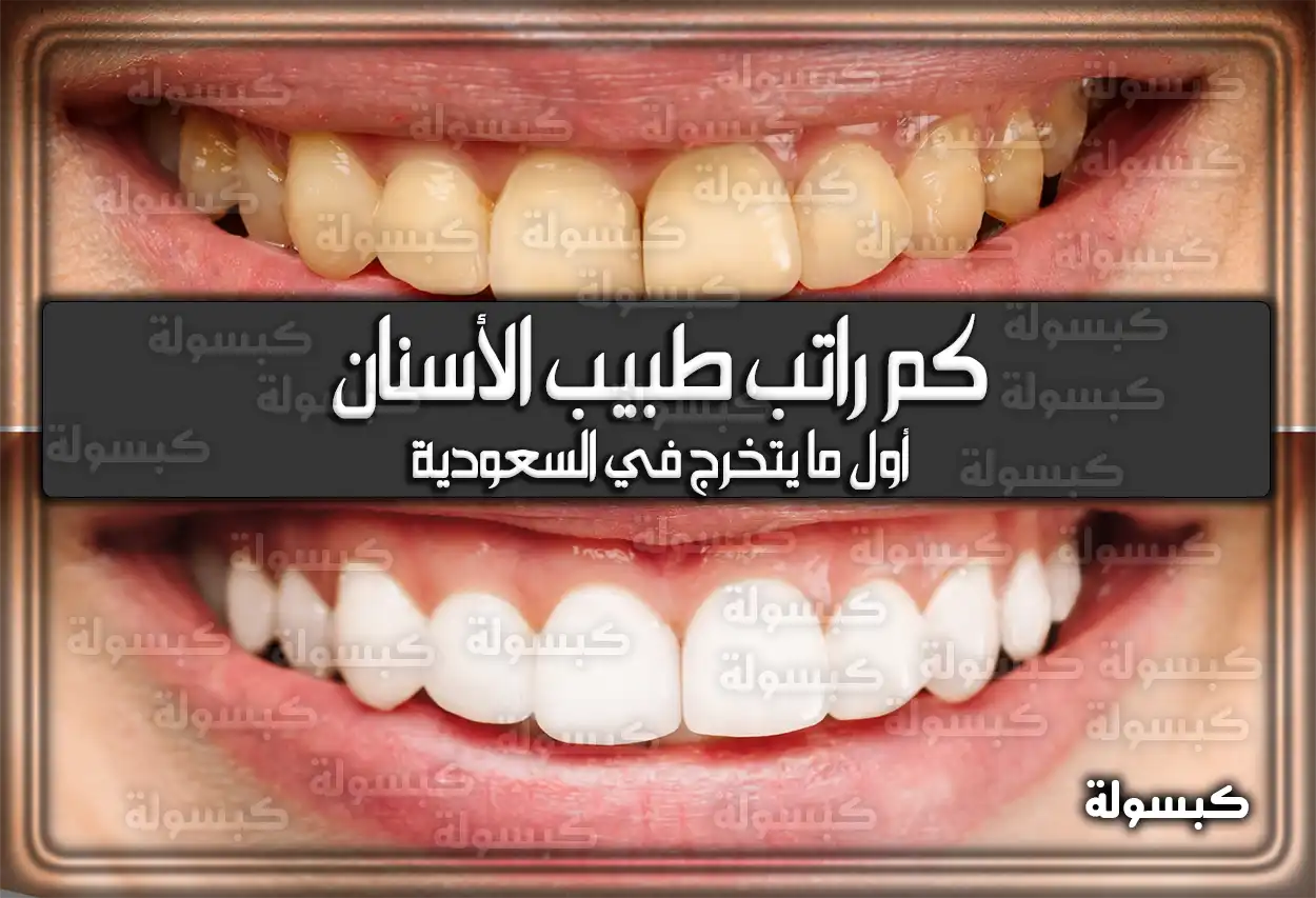 كم راتب طبيب الأسنان أول ما يتخرج في السعودية 1447 – 2026 ؟