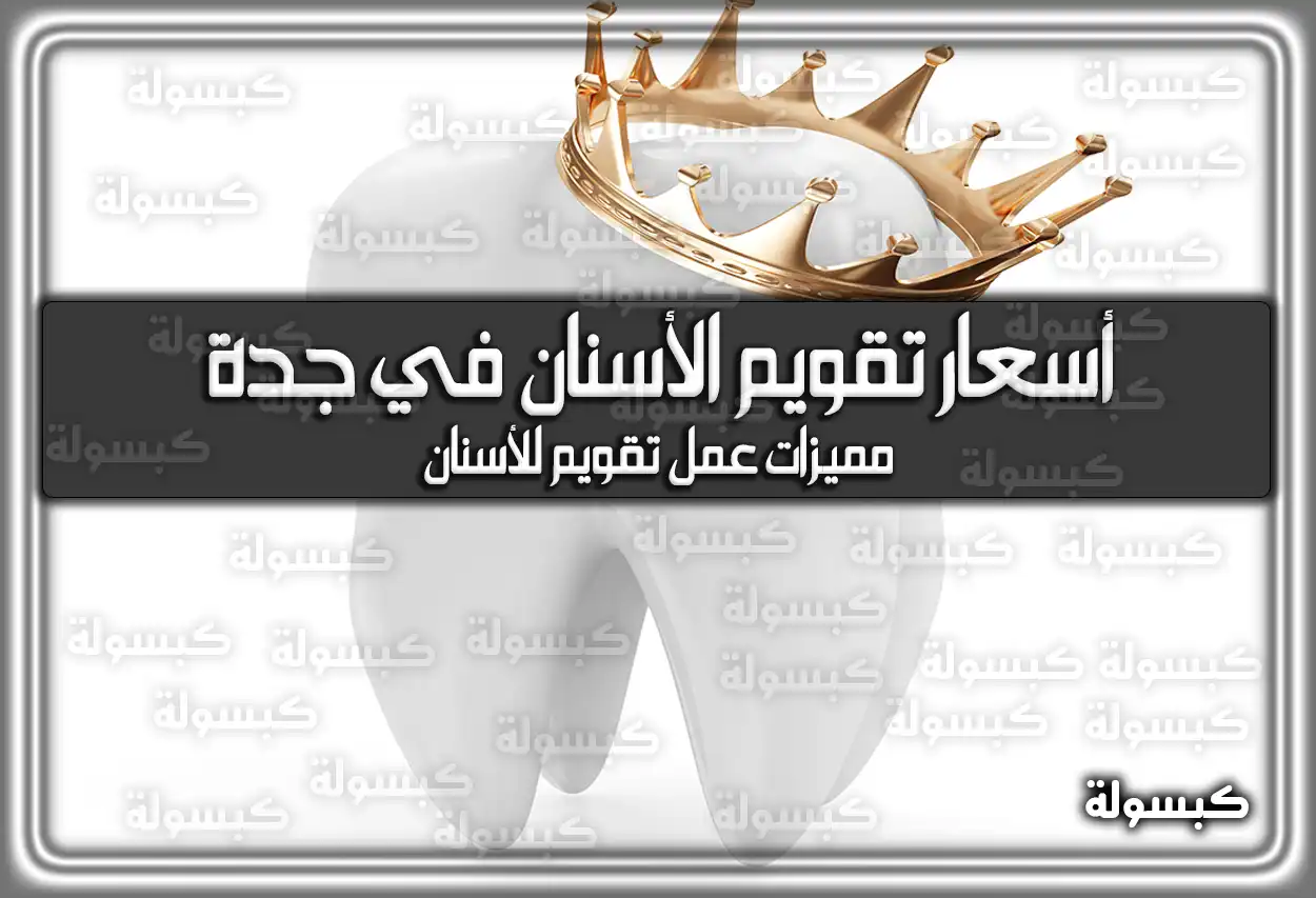 أسعار تقويم الأسنان في جدة السعودية