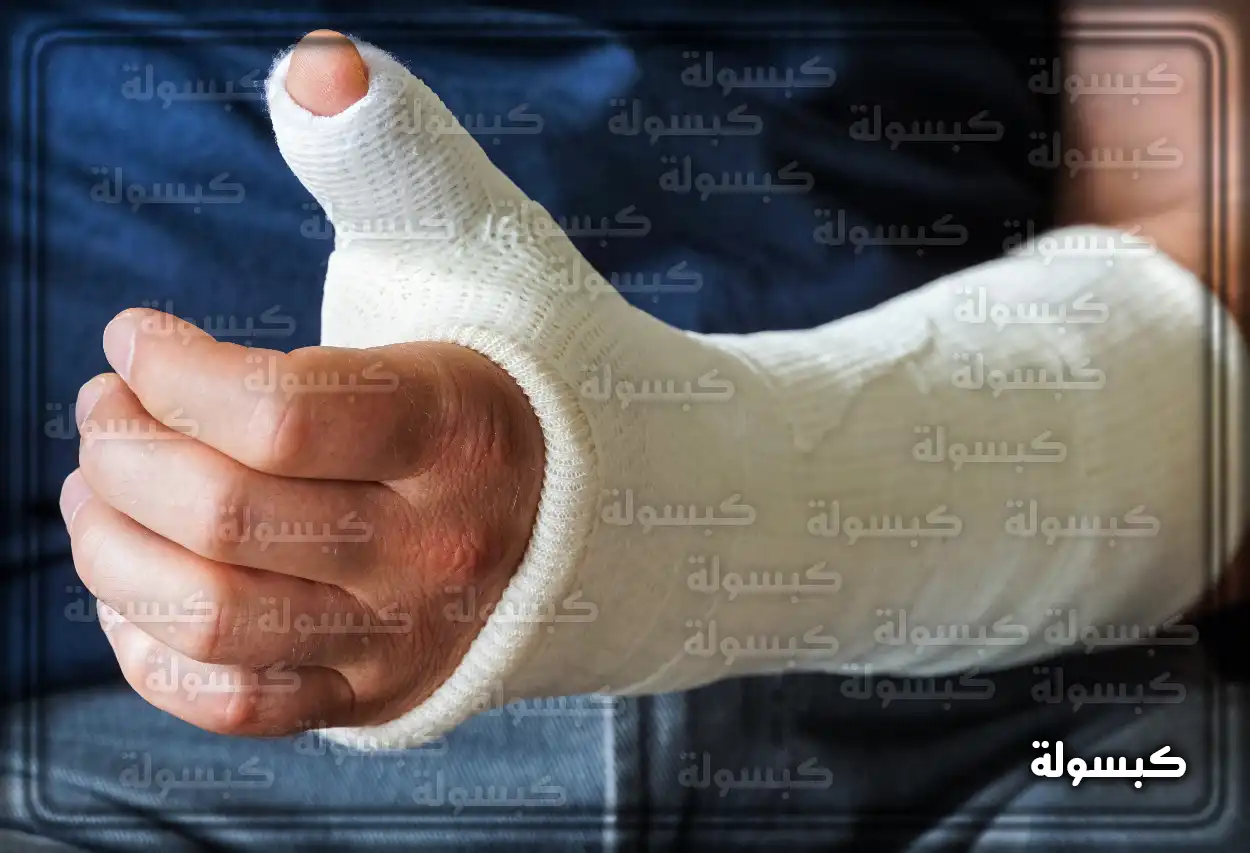 تفسير رؤية حلم كسر اليد في المنام