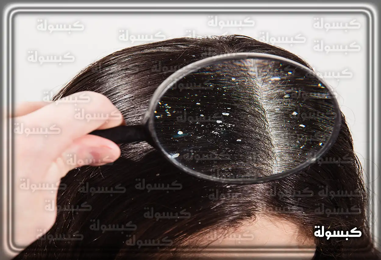 رؤية قشرة الشعر في المنام للمرأة