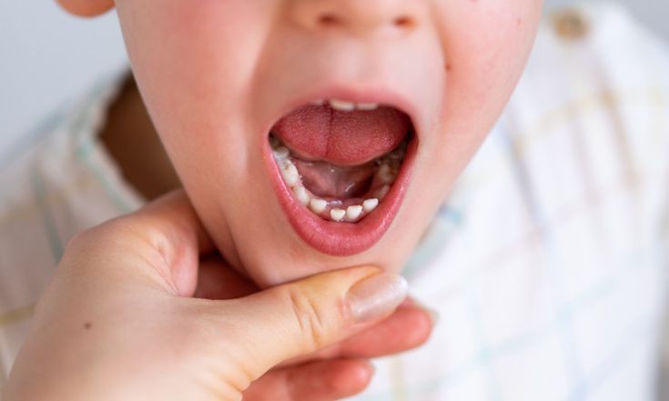 تفسير حلم خلع سن واحد