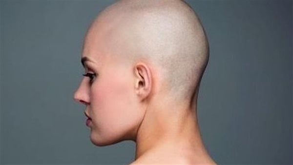 تفسير رؤية امرأة صلعاء في المنام