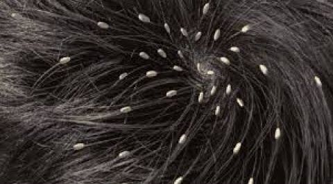 تفسير رؤية القمل في المنام