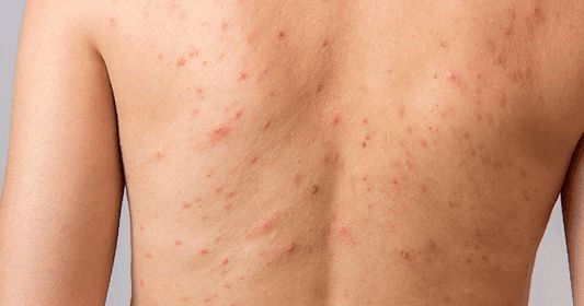 تفسير رؤية الحبوب في المنام