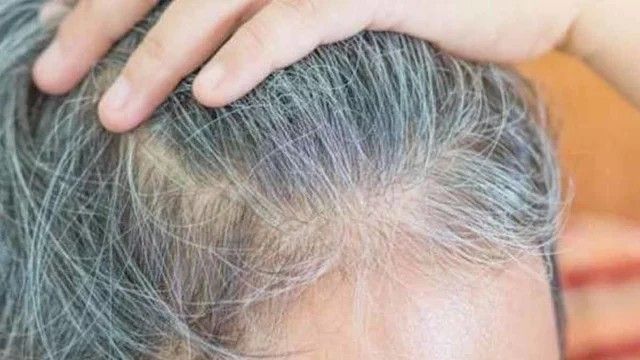 تفسير حلم الشعر الأبيض في المنام