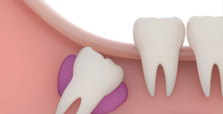 تفسير حلم الضرس في المنام