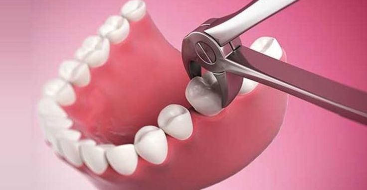 تفسير حلم الضرس في المنام