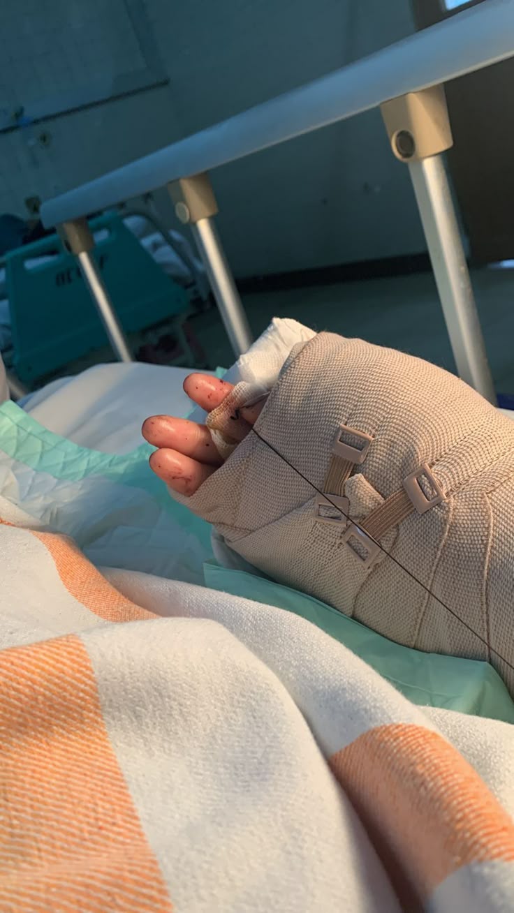 تفسير رؤية قطع الإصبع في المنام