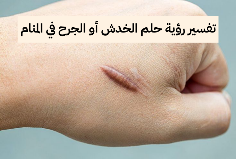 تفسير رؤية حلم الخدش أو الجرح في المنام .. مصائب وإنفصال