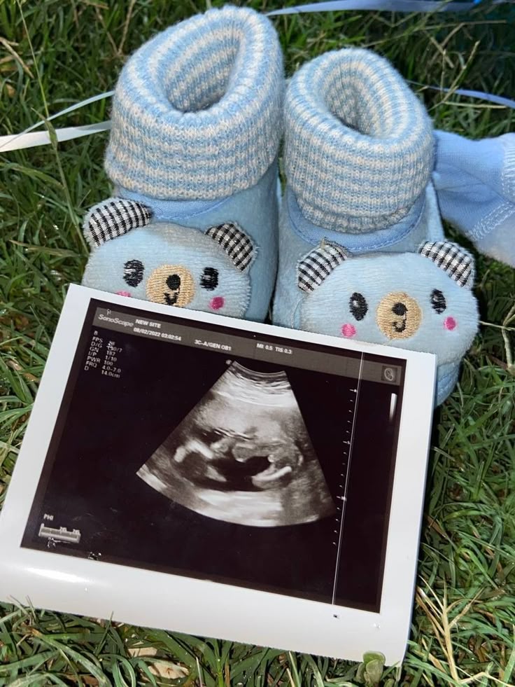 تفسير حلم الحمل