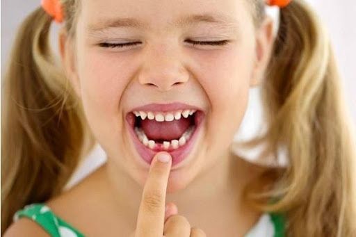 تفسير حلم سقوط الأسنان